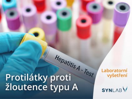 Test protilátek proti žloutence typu A Synlab