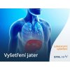 Preventivní balíček vyšetření jater Synlab