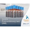 QUICK - Protrombinový test (INR)