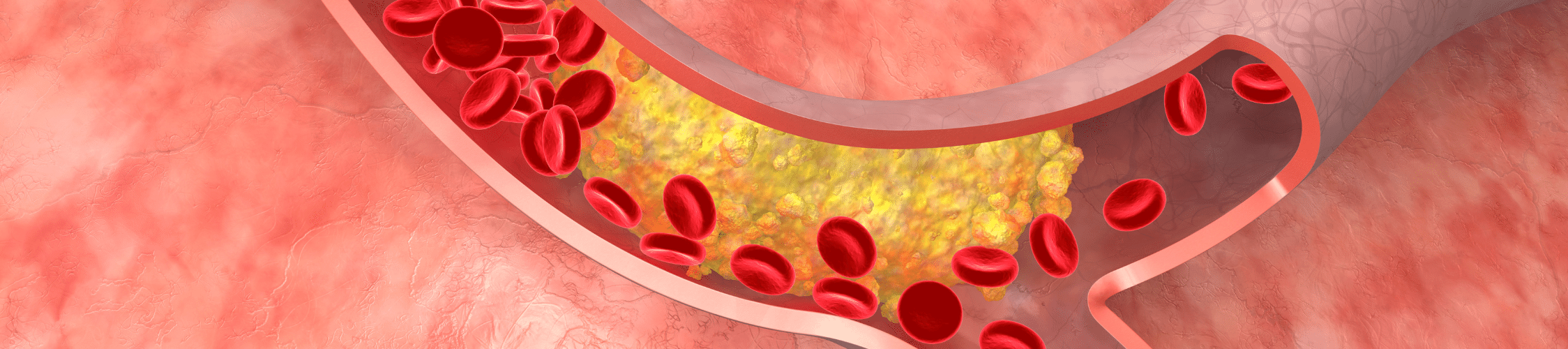 cholesterol-test-synlab