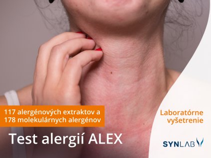 Test alergií ALEX Synlab laboratórium