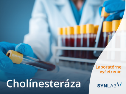 Cholínesteráza