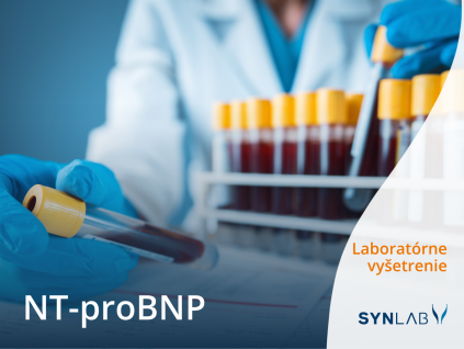 NT proBNP