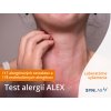 Test alergií ALEX Synlab laboratórium laboratórne vyšetrenie
