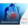 Vyšetrenie pečene