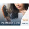 Vypadávanie vlasov