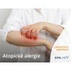 atopické alergie