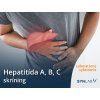 hepatitídy