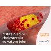 Zistite hladinu cholesterolu Synlab laboratórne vyšetrenie