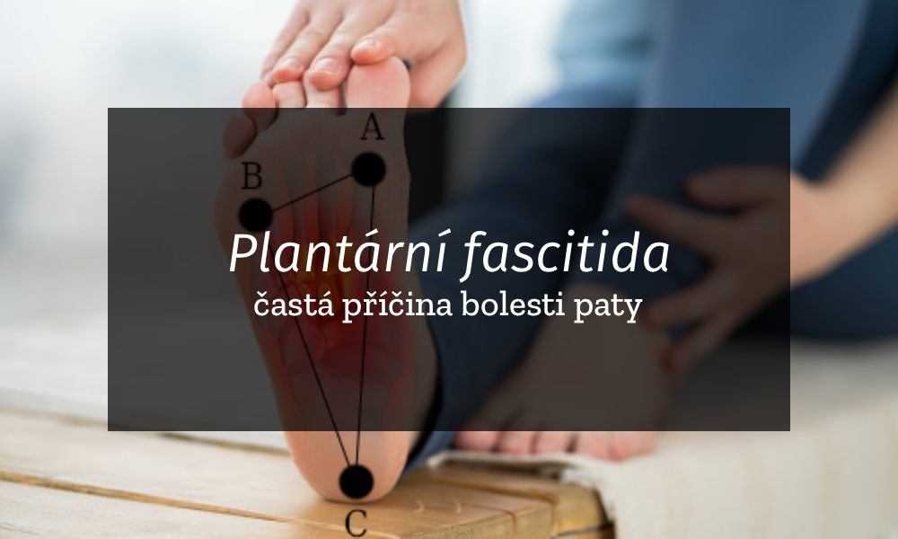 Plantární fascitida