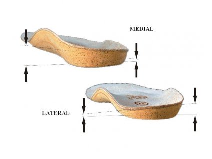 Ortopedické vložky LATERAL - varozita