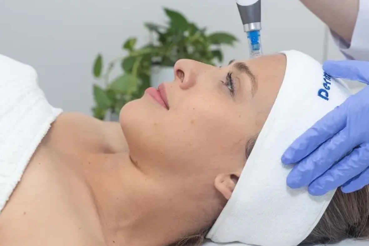 Mikrojehličkování a proč do toho jít?