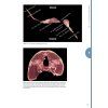 Equine Myofascial Kinetic Lines – for professionals
