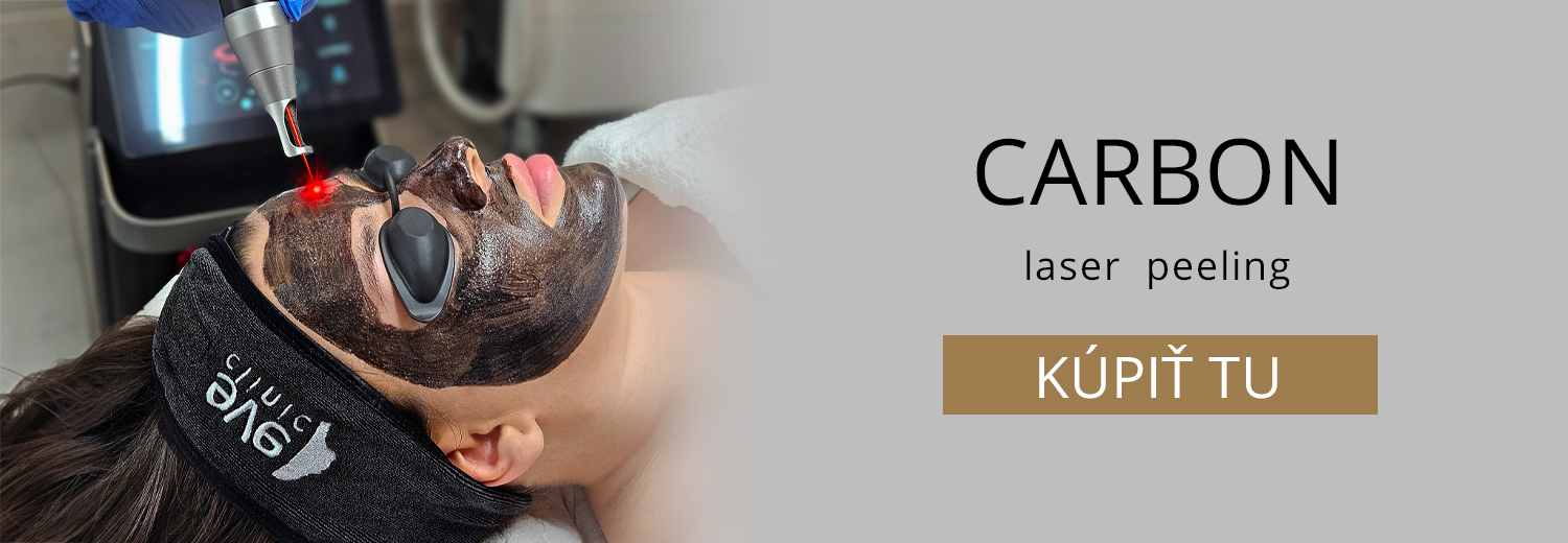 carbon laser peeling