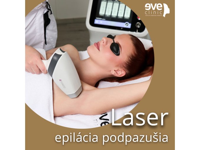 Laser epilácia podpazušia
