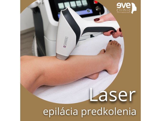Laser epilácia predkolenia