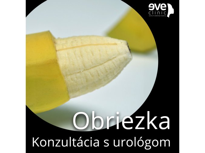 obriezka zmena