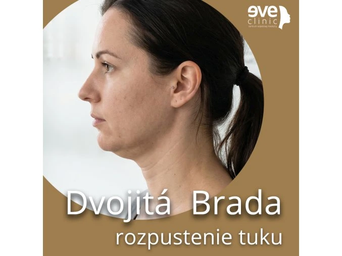 dvojita brada