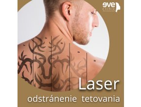 tetovanie 1