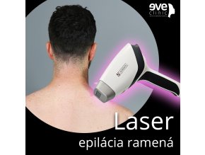 epilaácia ramená copy