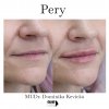 pery insta post