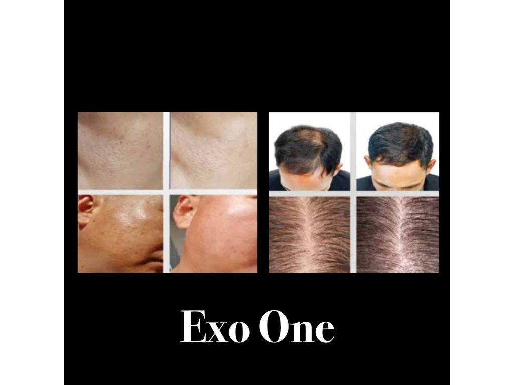 Tajná zbraň proti padání vlasů? Existuje!