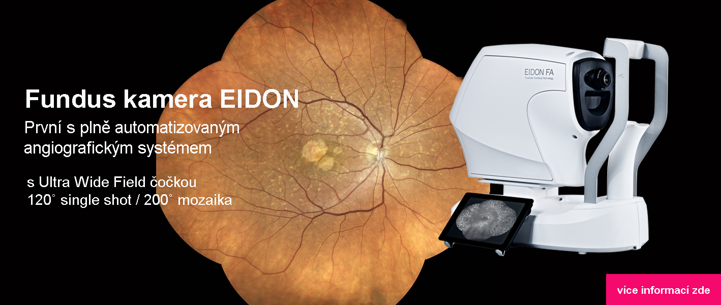 fundus kamera eidon
