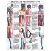 anatomicky plakat tejpovani pruznymi tejpy