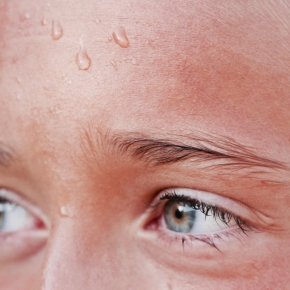 Trápí vás nadměrné pocení? Řešení existuje