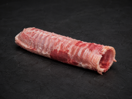trachea