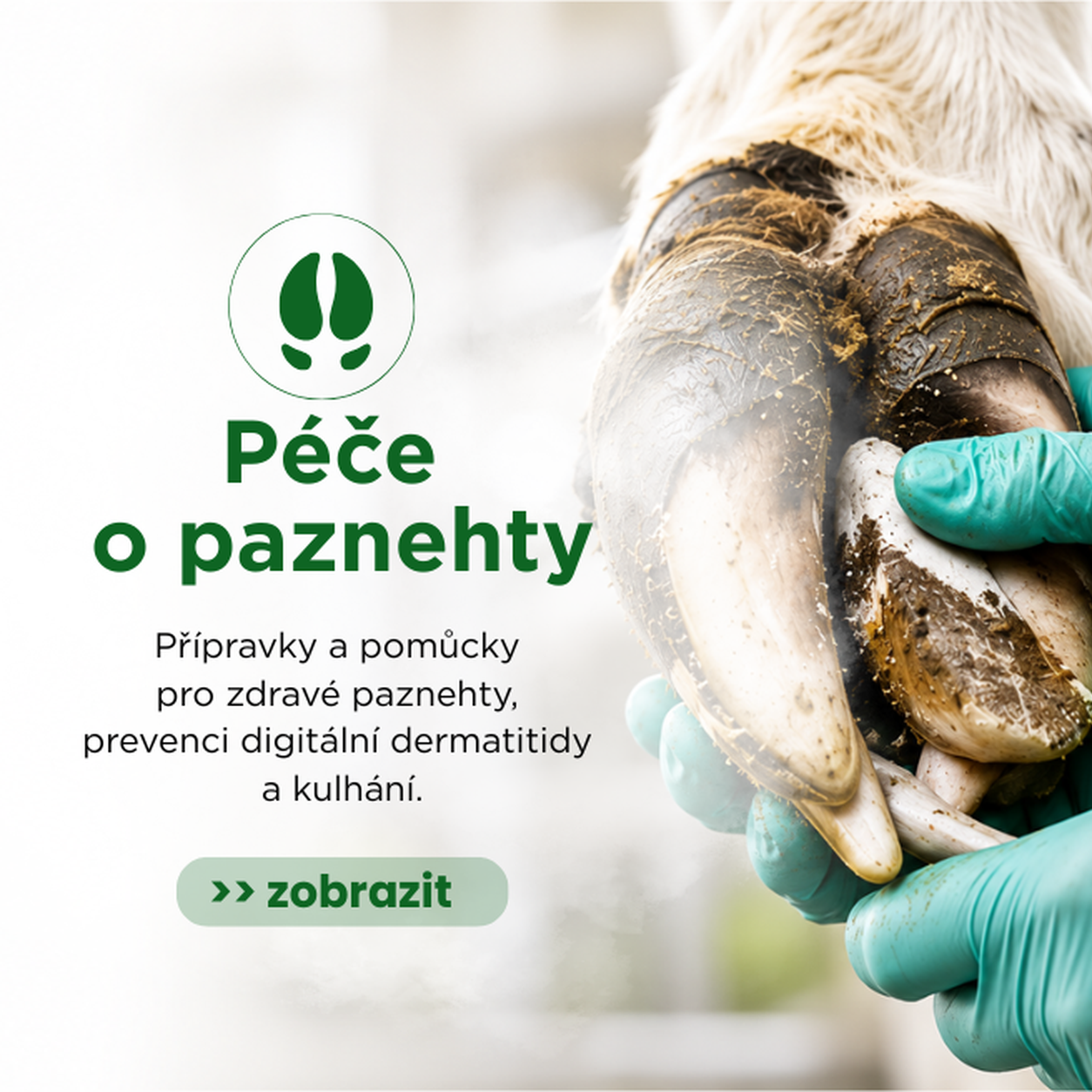 Péče o paznehty