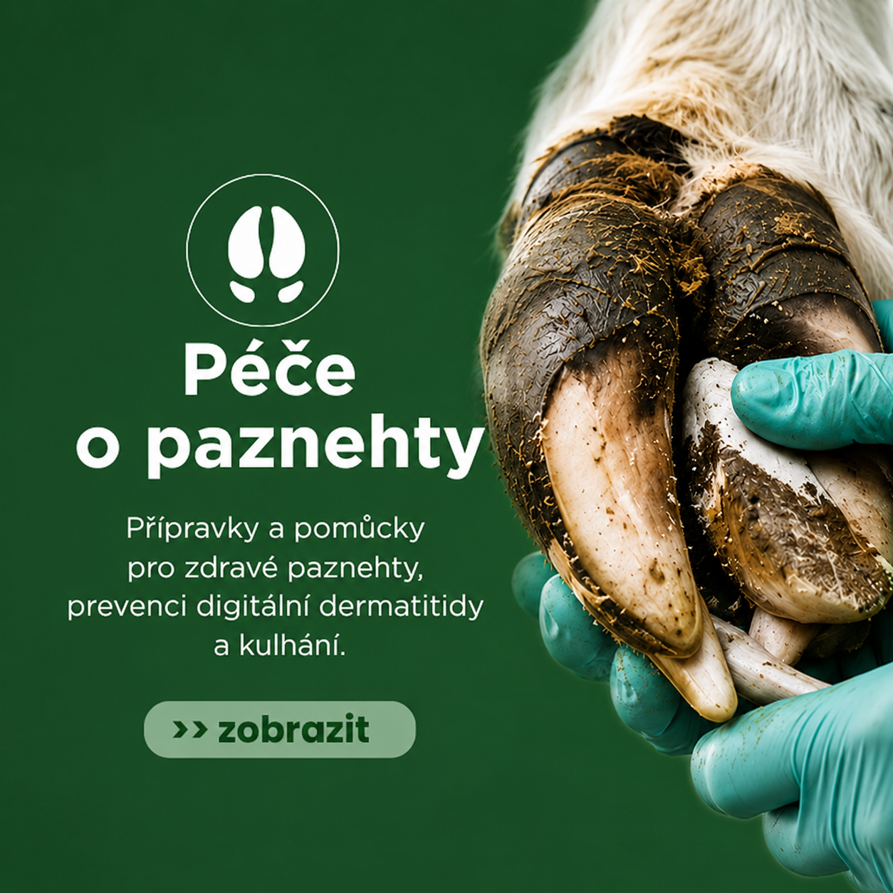 Péče o paznehty