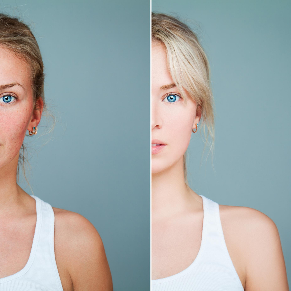 Puterea naturii pentru o piele radiantă și sănătoasă