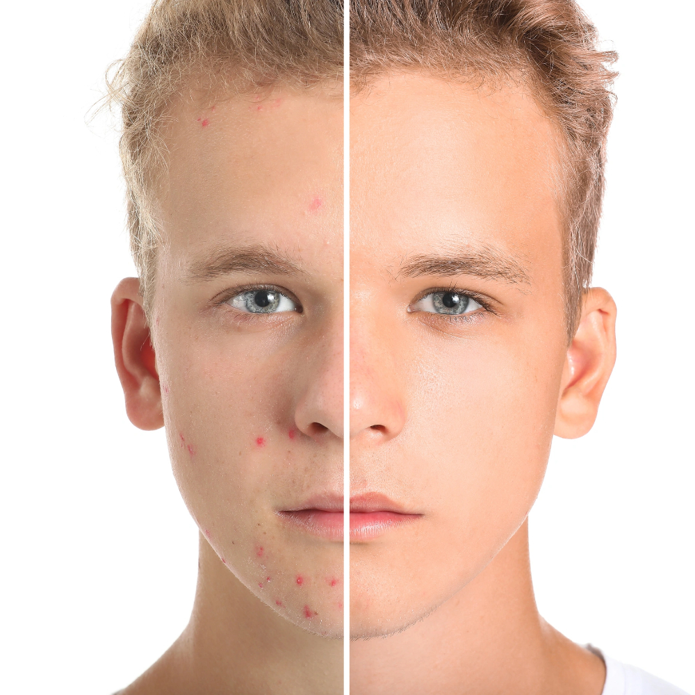 Силата на природата за сияйна и здрава кожа