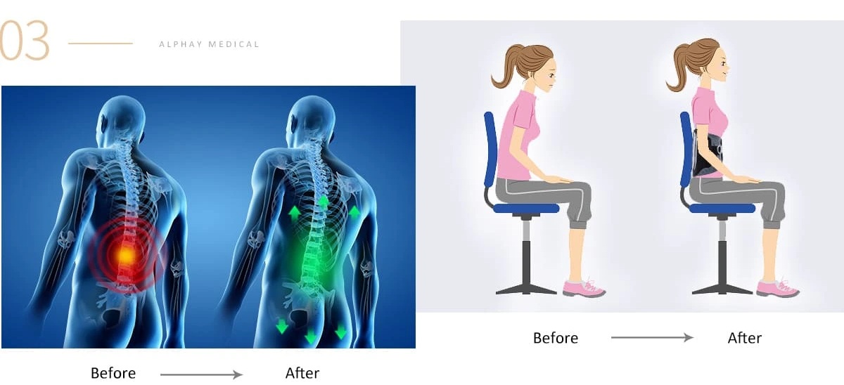 bederni_pas_before_after