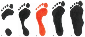 Footprints, flat feet