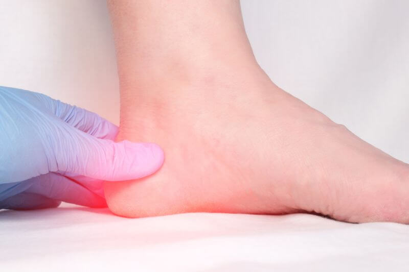 What is Ankle Bone Spur? Symptoms, Causes, Diagnosis & Physiotherapy  Treatment of Ankle Bone Spur...