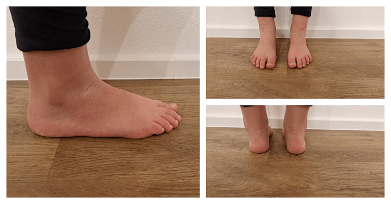 Children feet, size 31