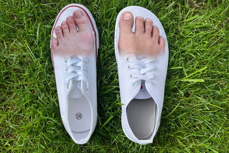 Stlačené prsty v běžné botě oproti volným prstům v barefoot botě