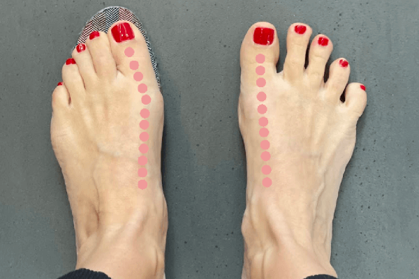 Warum sind Barfußschuhe so breit?