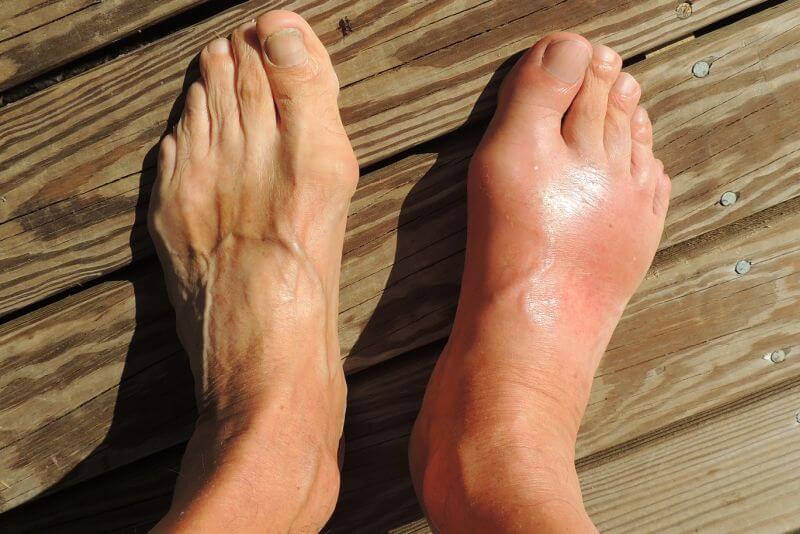 rückenschmerzen falsche schuhe