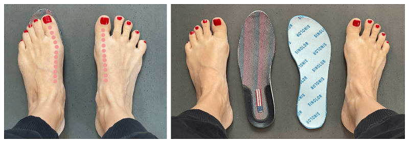 Herkommliche Schuhe vs. Barfussschuhe
