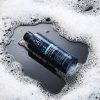 ANTI DANDRUFF1