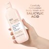 87536 4 kindness salicylic acid