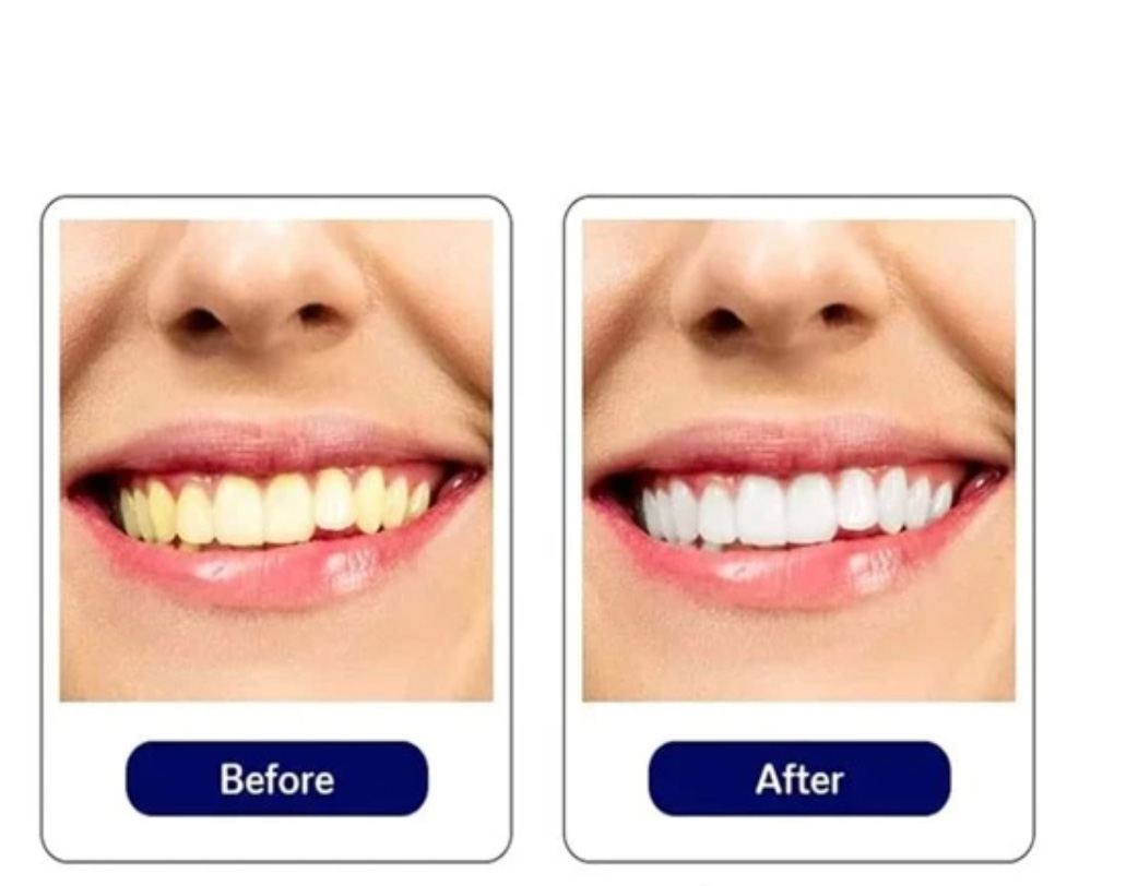 dental-white2