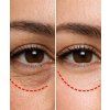 Arocell Botulcare wrinkle solution eye cream