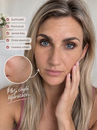💗 Suchá, unavená pleť bez šťávy? Dopřejte jí pořádnou dávku hydratace! 💦✨ Seznamte se s GLAMFOX Collagen Hyaluronic...