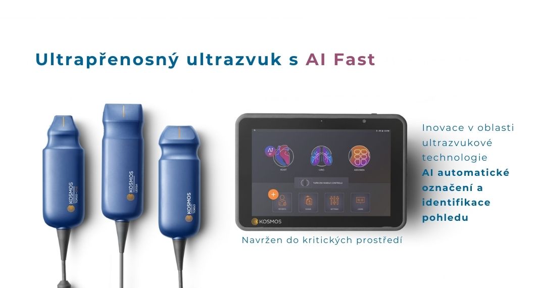 Ultrazvuk