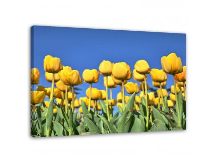 Obraz na plátně Žluté tulipány na louce