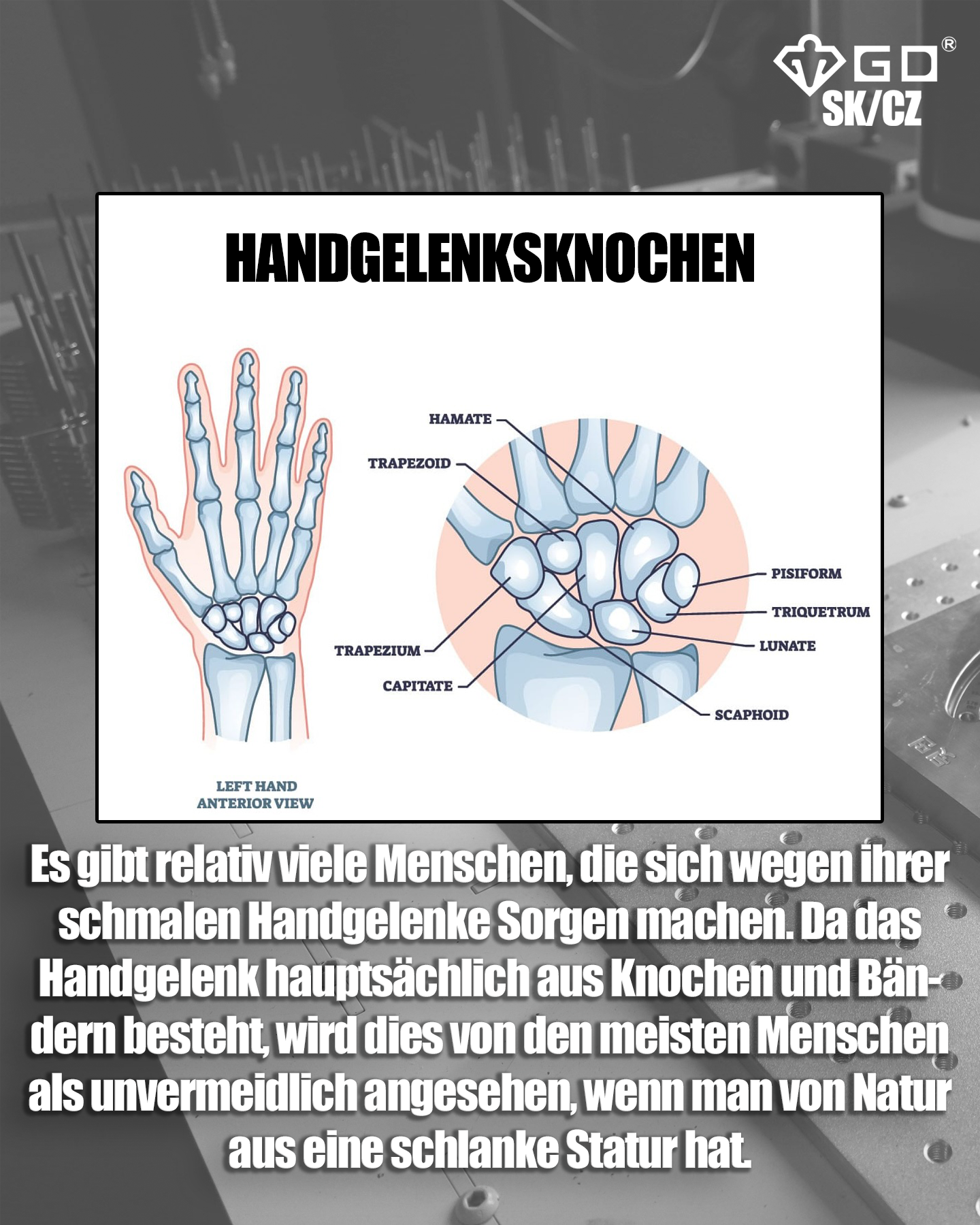 de_article3_02_EinschmalesHandgelenkDE02